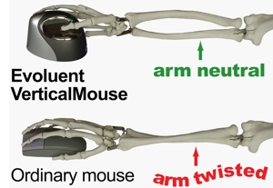 computer accessory computers  The Mouse, Evolved